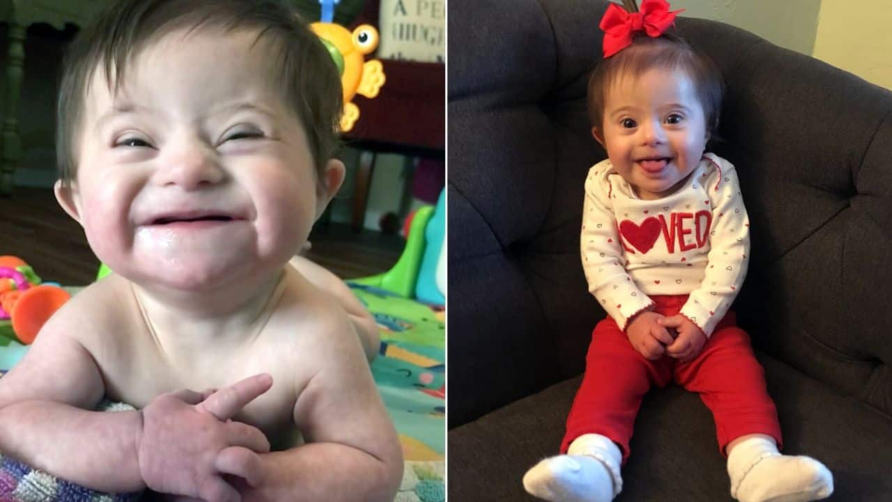 Baby With Down Syndrome Smiles After Adoption