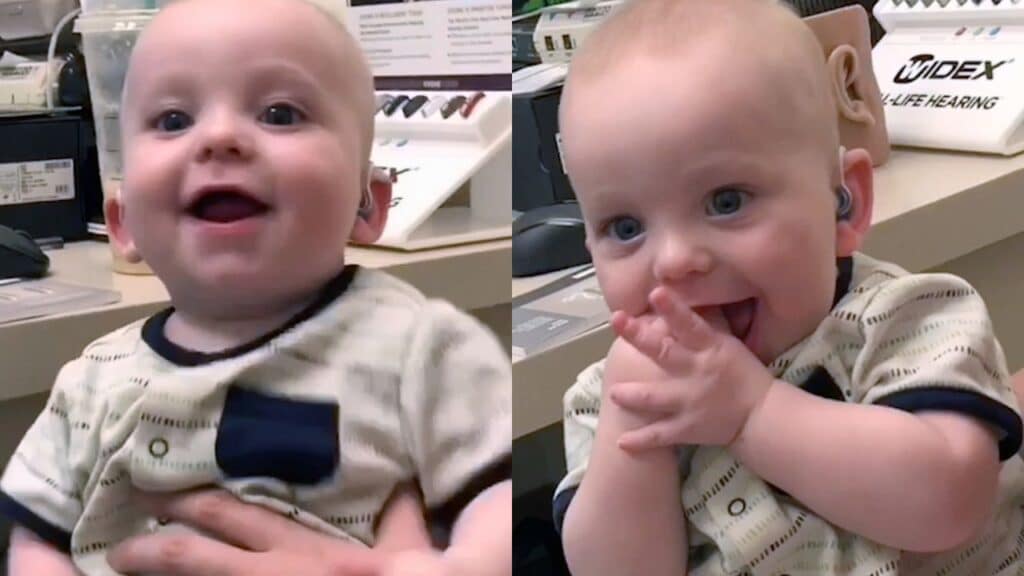 Baby hears for the first time