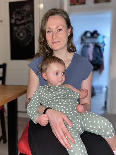 Toddler With One Arm Meets Adult With Same Condition