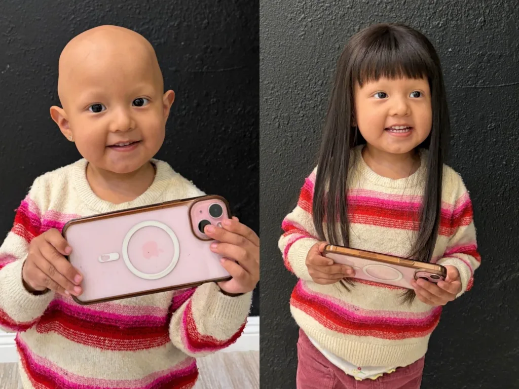 Before and after image of Lorelai showing her without hair and then wearing her new wig